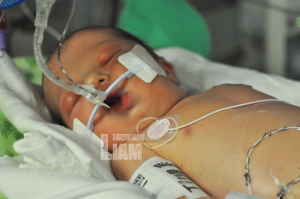 CHD, Legendary Liam